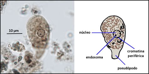 Fotografía Izquierda Y Esquema Derecha De Un Trofozoíto De E Coli Download Scientific