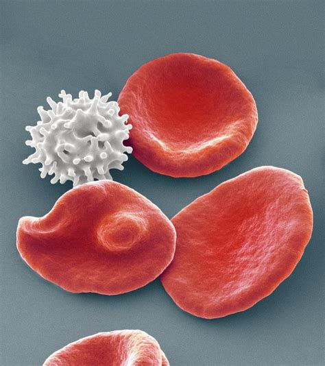 Healthy And Crenated Red Blood Cells Sem Photograph By Steve Gschmeissner