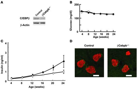 JCI Ablation of C EBPβ alleviates ER stress and pancreatic β cell