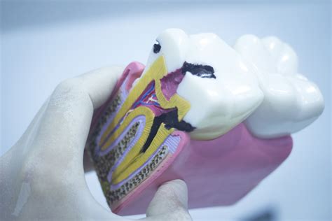 simple tips  preventing cavities chisholm trail