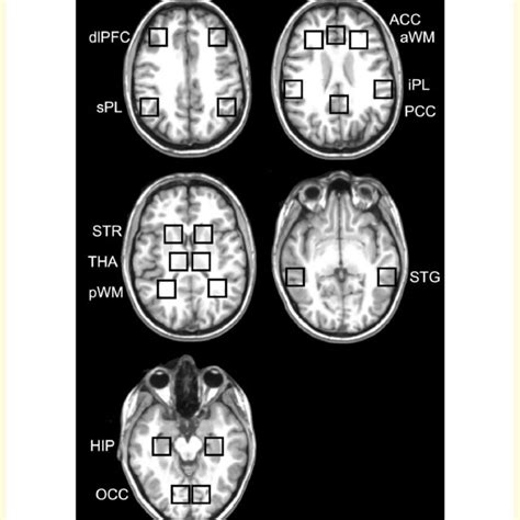 Anatomical Placement Of The P Mrs Voxels Five Different In Plane