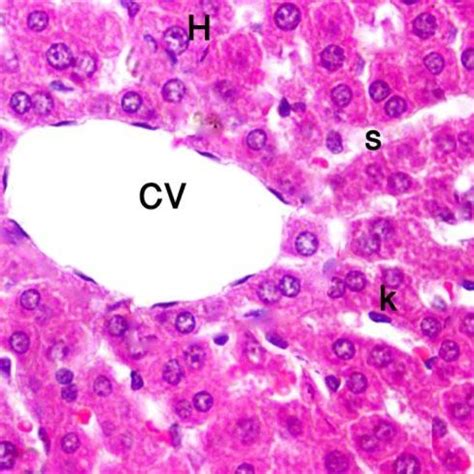 A Photomicrograph Of Section In The Liver Of Control Group Showing