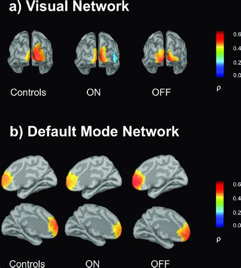 Visual And Default Mode Eeg Networks Bestfitting Components A Visual