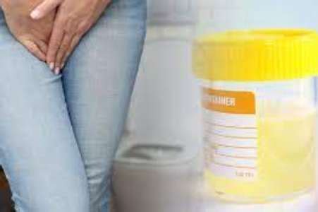 Cloudy Urine Causes Symptoms Treatment