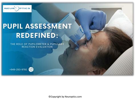 PPT - Pupil Assessment Redefined: The Role of Pupilometer & Pupillary ...