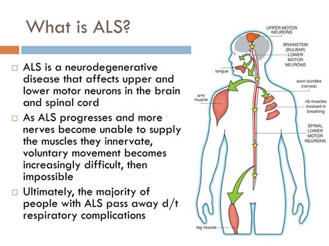 Ppt Amyotrophic Lateral Sclerosis Als Powerpoint Presentation Free