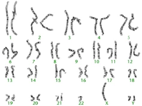 High Resolution G Banded Chromosomes From An Individual With A 47xyy Download Scientific