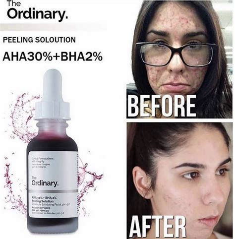 The Ordinary Aha 30 Bha 2 Peeling Solution Facial Skin Care Routine