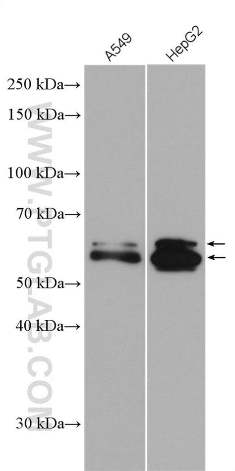 Usp Rabbit Anti Human Mouse Rat Polyclonal Proteintech L