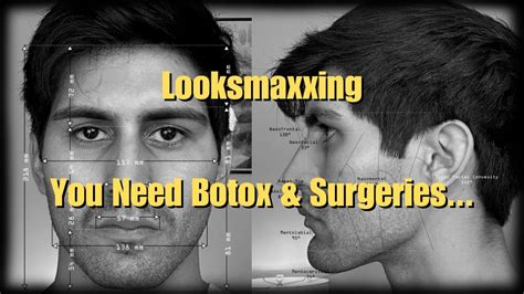 I Paid 300 To Maximize My Facial Aesthetics With Qoves Looksmaxxing Report Youtube