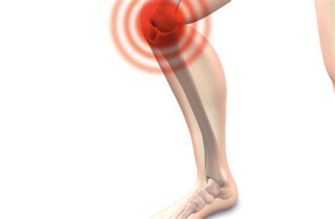 Treatments On Knee Osteoarthritis KOA With Acupuncture FTCMCC