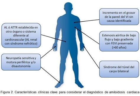 SIAC Evaluación y Tratamiento de Pacientes con Amiloidosis Cardiaca