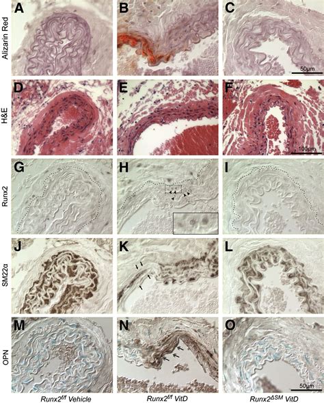 Runx2 Expression In Smooth Muscle Cells Is Required For Arterial Medial