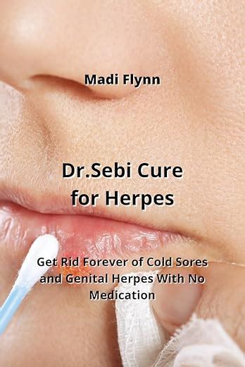 Drsebi Cure For Herpes Get Rid Forever Of Cold Sores And Genital