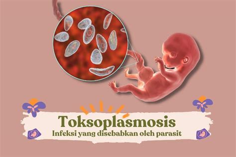 Toksoplasmosis Gejala Penyebab Dan Cara Mengobatinya