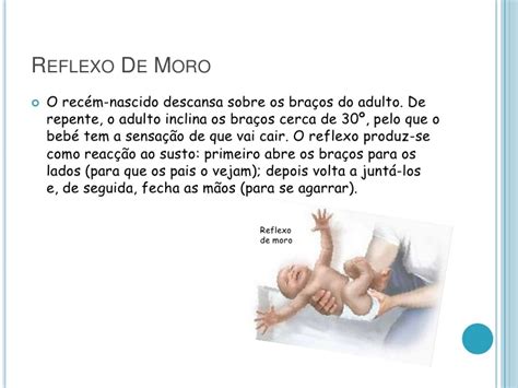 O Que É Reflexo De Moro - Você sabe o que é reflexo de Moro? Clique e saiba sobre esse exame ...