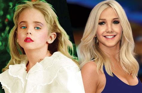 Gone Too Soon — How Tragic Beauty Queen Jonbenét Ramsey Would Ve Looked Today