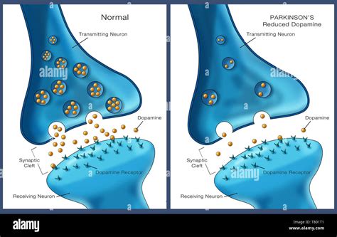 Parkinsons And Dopamine Illustration Stock Photo Alamy