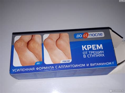 Крем от трещин в ступнях Твинс Тэк До и После усиленная формула с ...