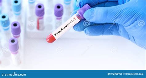 Doctor Holding A Test Blood Sample Tube Positive With Mycoplasma Test