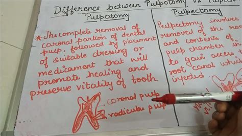 Difference Between Pulpotomy And Pulpectomy Pedodontics YouTube