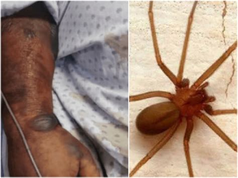 Muere hombre por picadura de araña violinista en Guanajuato, México ...