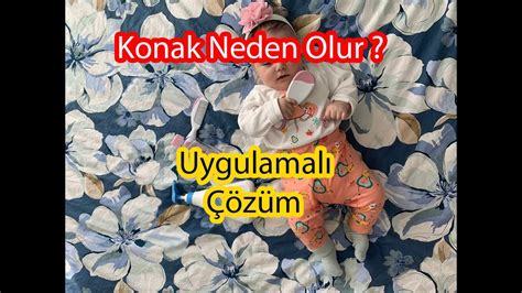 BEBEKLERDE KONAK NEDEN OLUR KONAK TEDAVİSİ NASIL YAPILIR Uygulamalı