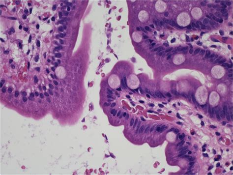 Giardia Histology