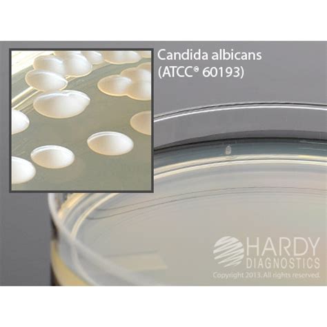 Hardy Diagnostic H39 Dry Culture Media Sabdex Agar Plate 90 Day Shelf