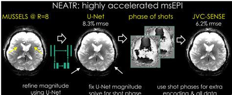 Neatr Is A Combined Machine Learning And Physics Based Reconstruction