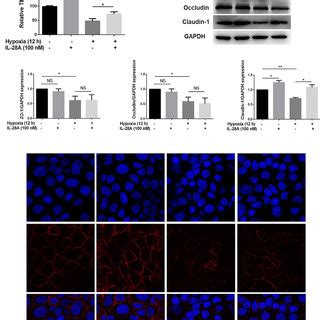 The Effects Of IL 28A On The Expression And Localization Of TJ Proteins