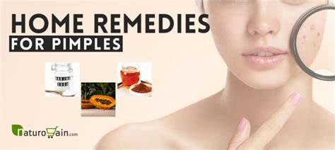 6 Home Remedies For Pimples Get Rid Of Acne Naturally [and Quickly]