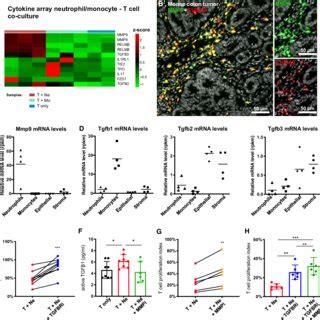 Tumor Neutrophils Suppress T Cells In Vitro Via Mmp Mediated Tgf Beta