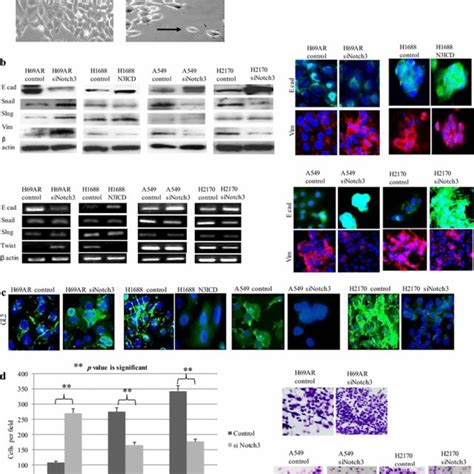 Molecular Pathway For Notch3 Signaling In A Human Sclc And B Human Download Scientific