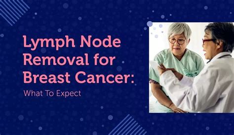 Lymph Node Removal for Breast Cancer: What To Expect : r/AllGoodTutorials