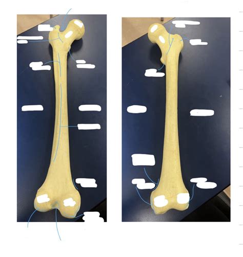 Osteology Of Femur Lab Diagram Quizlet