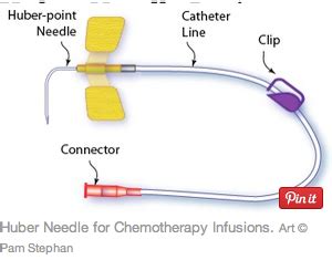 Port-a-cath needle removal - Oncology Nursing