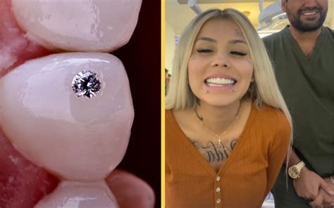 Mona presume sus dientes con diamantes más de 30 mil pesos cada uno