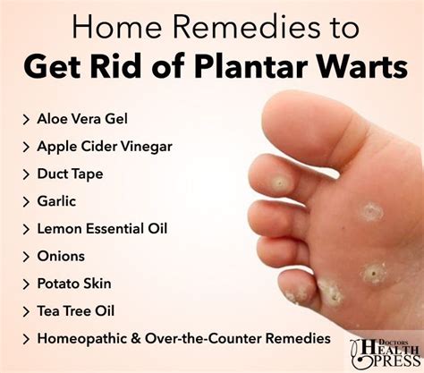 how to get rid of warts at home
