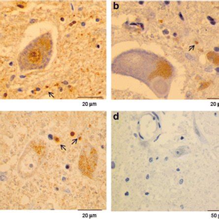 Immunohistochemical Staining Of GFAP In Brain And Spinal Cord Samples