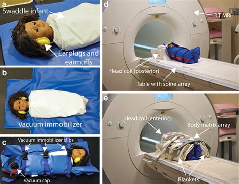 Infant Mri Procedures Ac Initial Preparation For The Infant Scan A