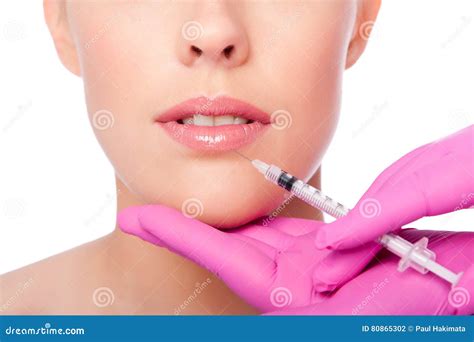 Beauty Lip Collagen Filler Injection Stock Photo - Image of skincare ...