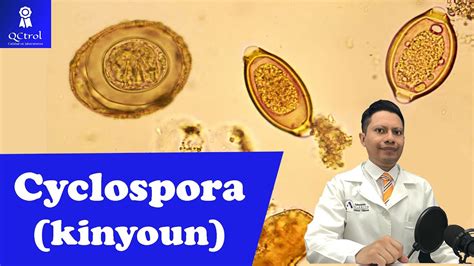 Conoce a Cyclospora cayetanensis con tinción de KINYOUN YouTube