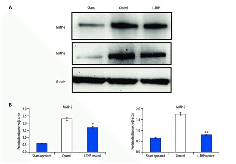 A MMP 2 And MMP 9 Expression By Western Blot Analysis In Aortic Wall