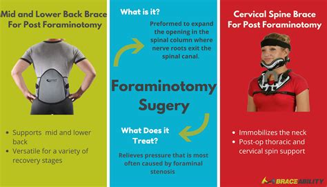 Types Of Back Braces After Surgery at Eva Edgley blog