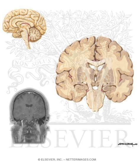 Coronal Sections Through The Forebrain Mammillary Bodies