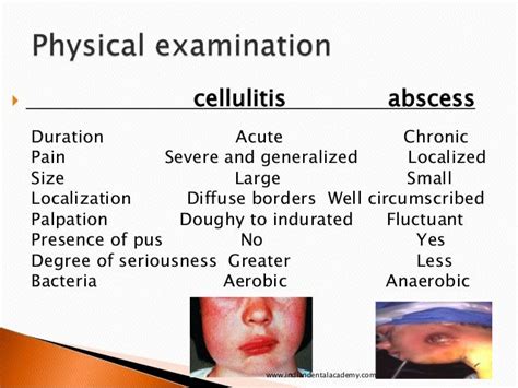 Copy Of Sequlae Of Odontogenic Infections Dental Implant Courses