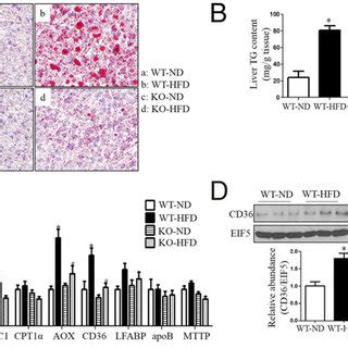 Cyp A Gene Deficiency Ameliorated Hfd Induced Hepatic Steatosis Male