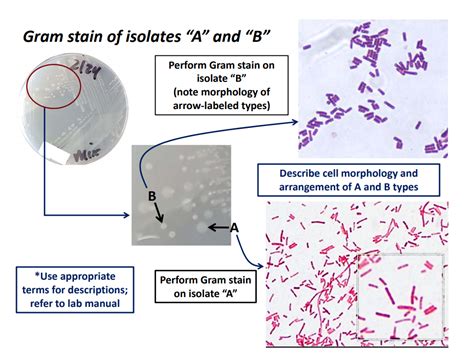 Bacillus Subtilis Morphology And Gram Stain