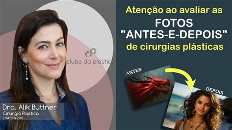 Clube da Plástica atenção ao avaliar as fotos de antes e depois da